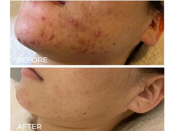 トット 恵比寿(totto)/ケア症例