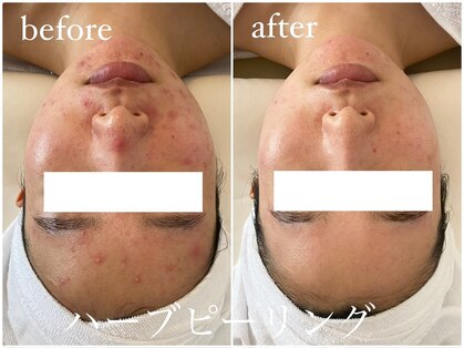 イム(I'm.)の写真