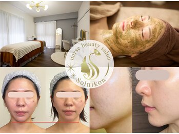 ソルニコン(Solnikon)