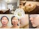 ソルニコン(Solnikon)の写真