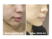 プライベートアトリエ 代官山の雰囲気(長年の悩みの開き毛穴や肌荒れ…一緒に艶肌を目指しましょう!)