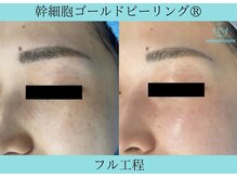 リメイク 広尾(REMAKE)/