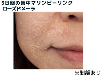 エープラス(A+)/ダウンタイム中