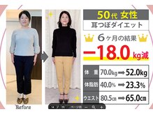 ミラクル ビー(ミラクル Bee)