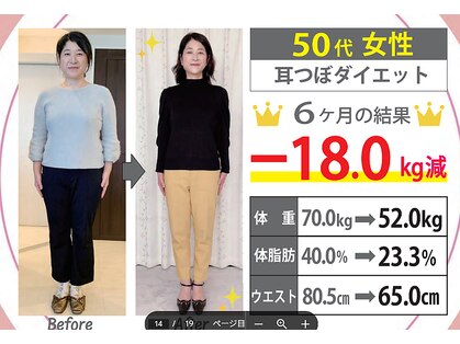 ミラクル ビー(ミラクル Bee)の写真