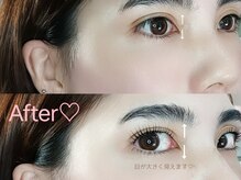 ペタリン(Petarin)/ラッシュリフト/マツパ