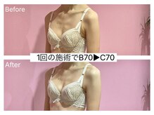 ククナ(KUKUNA)/*バストアップマッサージ*