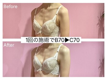 ククナ(KUKUNA)/*バストアップマッサージ*