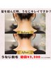 夏前に人気♪うなじ脱毛　¥3300