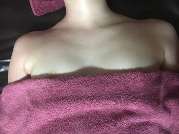 アンジェリークBB バストパレット本店/☆施術