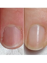 メイル(MEILU)/コンプレックスから美人爪へ