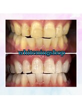 ホワイトニングショップ 奈良香芝店(Whitening shop)/美白ホワイトニング