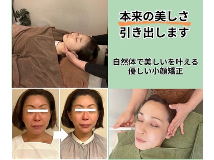 ベルソー(Berceau)の写真