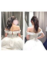 コーラル(Coral)/ブライダル痩身（施術結果）