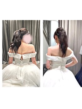 コーラル(Coral)/ブライダル痩身(施術結果)