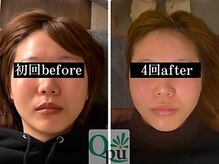 キュープ 鹿児島伊集院店(Qpu)/