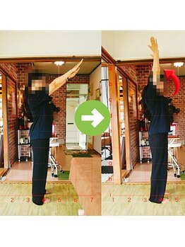 サプライズ整体院/30代ママさんの肩こり初回結果