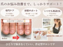 キュアネイル(Qa Nail)