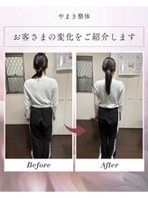 やまき整体/いかり肩から自然な美肩へ！！