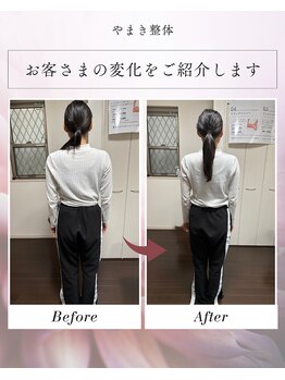 やまき整体/いかり肩から自然な美肩へ!!