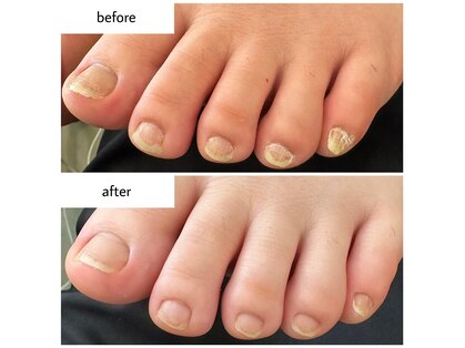 ネイルアトリエ ボン(nail atelier bon)の写真