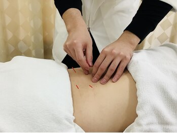 いのラボ 小新院の写真/美容鍼でお肌のお悩みにアプローチ！ハリ艶肌へ導きます♪ストレスや睡眠不足で乱れがちな自律神経にも◎