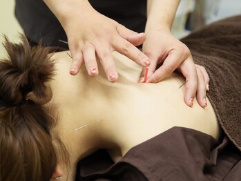 エムハナ鍼灸院(M.hana鍼灸院)/日常的に続く痛みや疲労に最適！