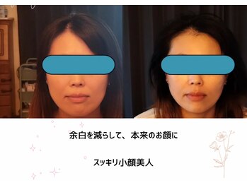 花鍼灸院/ビフォアフ