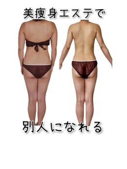 ラエッセス(A Laessess)/美痩身エステで別人化