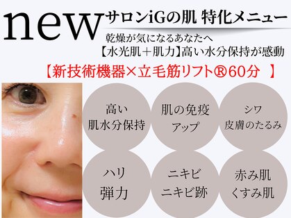 アイジー(iG)の写真