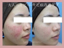 エピア 三河安城店(Epia)