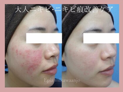 エピア 三河安城店(Epia)の写真