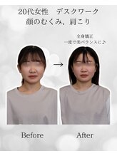 シナジェ 並木通り店(Synergye)/デスクワークの方、おすすめ！