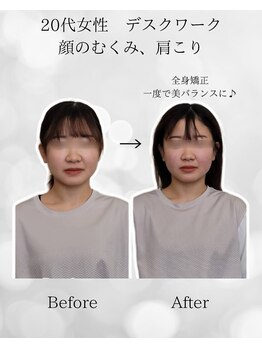 シナジェ 並木通り店(Synergye)/デスクワークの方、おすすめ！