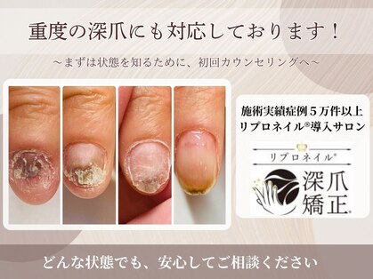 キュアネイル(Qa Nail)の写真