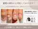 キュアネイル(Qa Nail)の写真