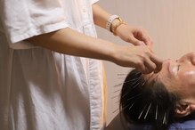 春鍼灸治療室