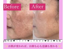 フェミニー(Feminy)/月一美容メンテナンスは当店で