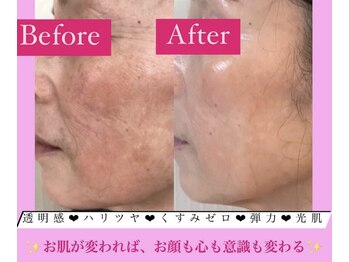 フェミニー(Feminy)/月一美容メンテナンスは当店で