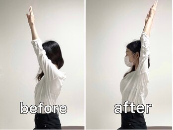 サンク(Cinq)/整体と骨盤矯正にて肩こり改善