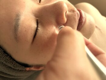 マシェリ(Macherie)の写真/毛穴の開き、お鼻の黒ずみ、くすみが気になる方に◎奥から潤う毛穴レスのたまご肌に♪ニキビケアにも！