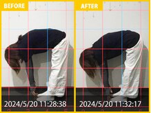 整体院 元 宇城松橋店/腰と肩こりの症状が改善