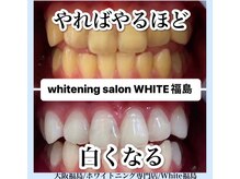 ホワイトニングサロン ホワイト(WHITE)/セルフホワイトニング/大阪/福島