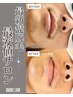 【ビジネスマンセット】　ヒゲ脱毛+手指脱毛