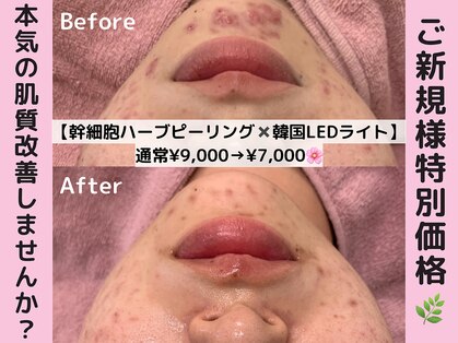 エンクリニカルラボ 三宮店(E&N CLINICAL LABO)の写真
