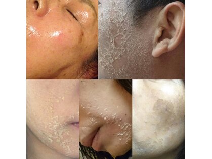 ビアンカ(bianca)の写真