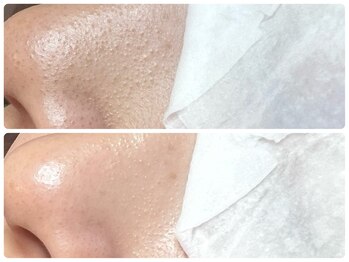 カピリナ(ka pilina)/毛穴詰まりもスッキリ！