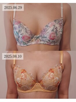 ブルーム(bluem)/短期集中！2か月・3回施術