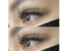 バインドロック