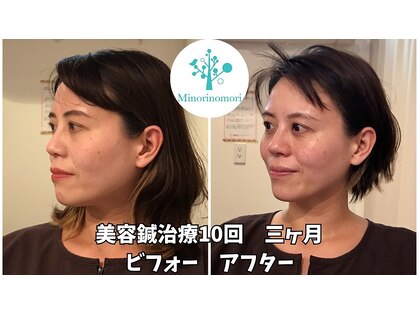 ミノリノモリ(Minorinomori)の写真